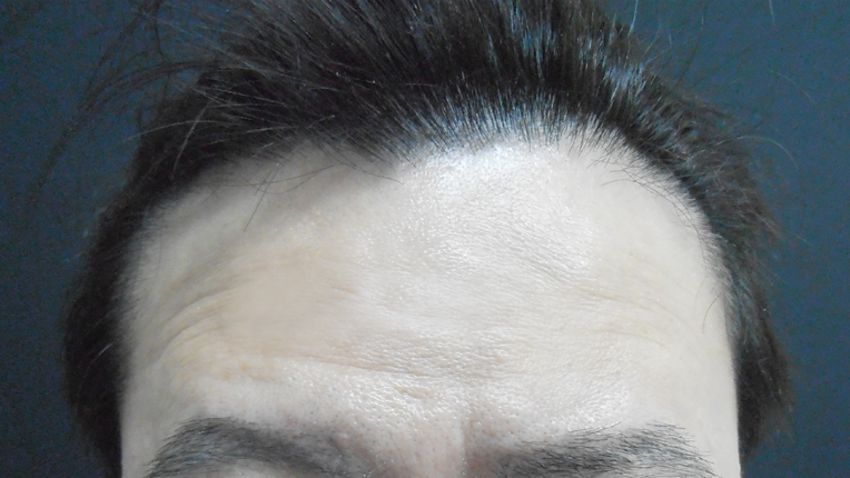 Αfter